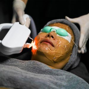 Facial Hair Removal