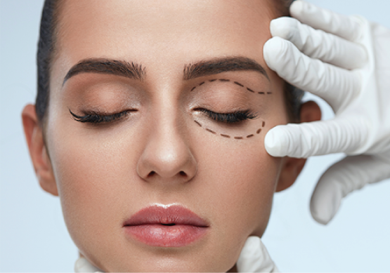Blepharoplasty Eyelid Surgery
